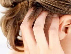 příznaky a příznaky psoriázy na pokožce hlavy